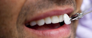 rehabilitacion oral en lima peru